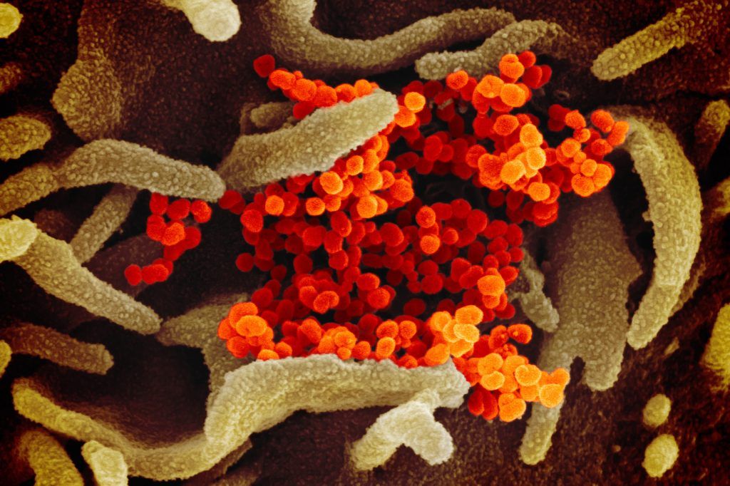 coronavirus-infectioncellule-strasbourg-1024x682.jpg